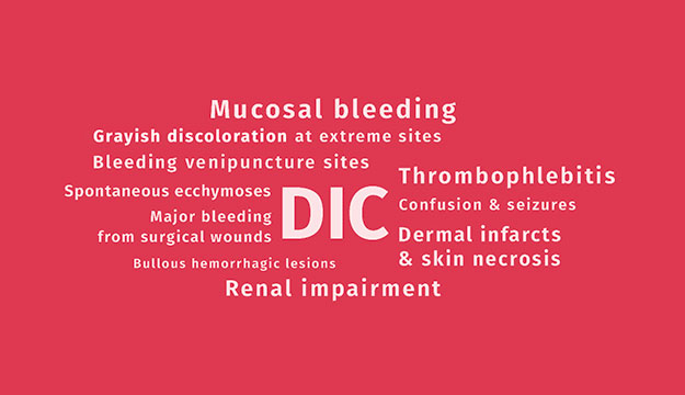 Severe Congenital Protein C Deficiency (SCPCD) symptom – Disseminated Intravascular Coagulation (DIC)